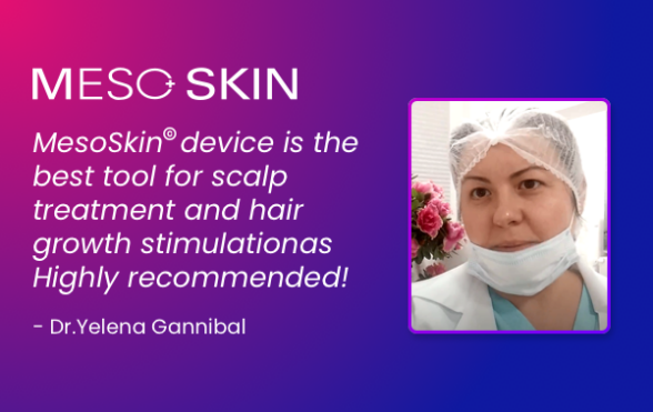 The scalp application of Mesoskin