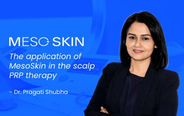 The application of Mesoskin in the scalp PRP therapy